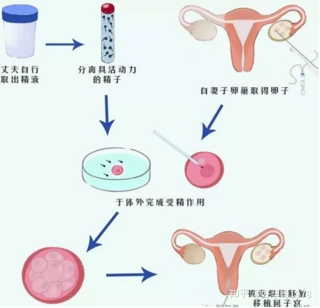 赠卵试管婴儿的男性精子要求