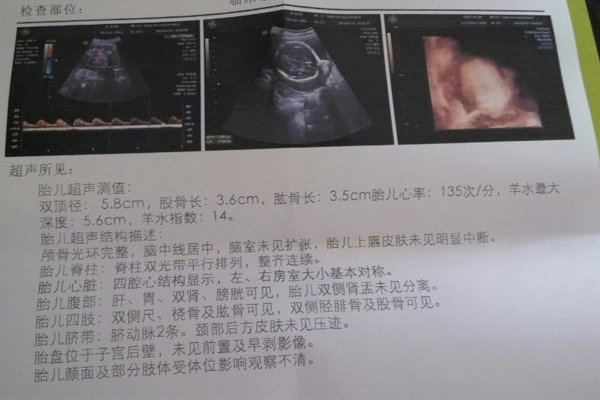 第一代试管和第二代第三代的区别,三种技术